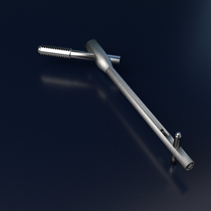 A short femoral nail with a lag screw